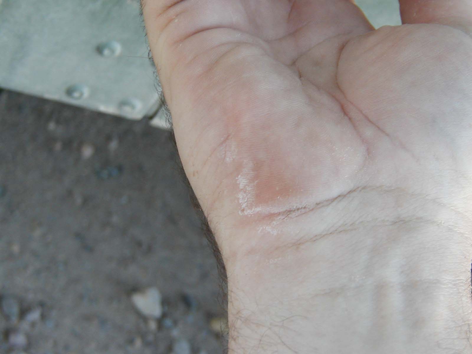 Salt2